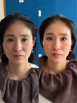 【敏感肌管理×小顔サロン】Belle orchid所属・敏感肌×小顔サロン 玲央奈のエステ・リラクイメージ