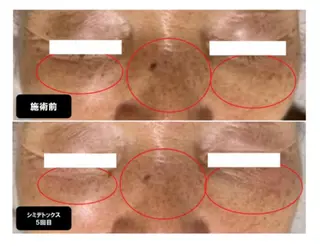 ヴィーナス ビューティーのエステ・リラクイメージ