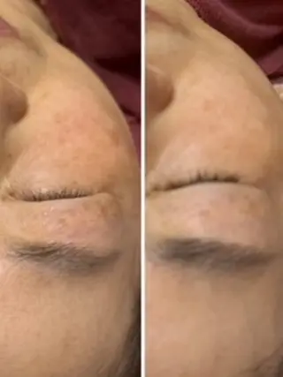 Lien オーナー　山口智嘉のエステ・リラクイメージ