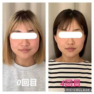 インタークロス所属・小顔矯正専門TIAM インタークロス池袋店のエステ・リラクイメージ