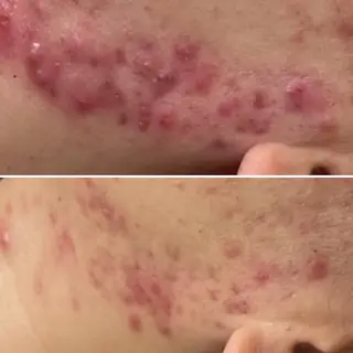 Beautysalonプルメリア所属・エステ プルメリアのエステ・リラクイメージ