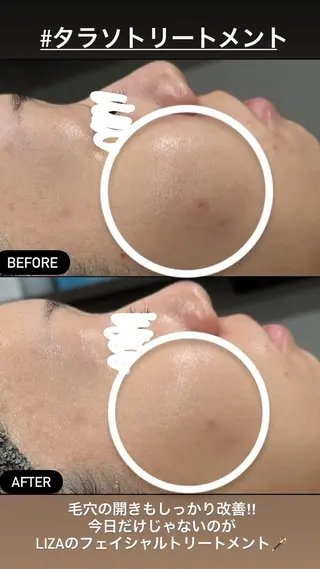 LiZA エステティックサロンのエステ・リラクイメージ