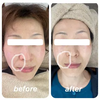 Venus所属・エステサロン Venusのその他イメージ