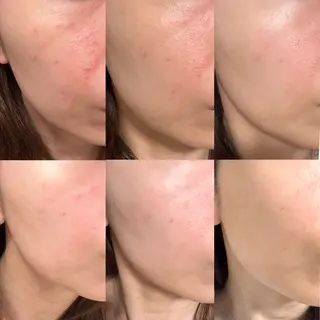 Charis エステ&ネイルのエステ・リラクイメージ