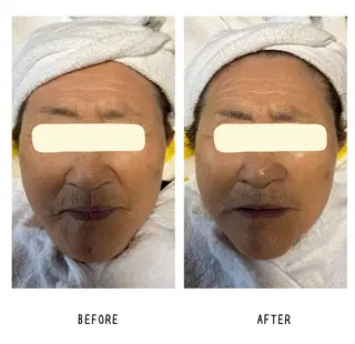 grow所属・Yoshino Erinaのエステ・リラクイメージ