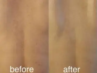 クレアス勝どき・肌質改善専門店【CREAS Beauty Salon】所属・クレアス勝どき【毛穴 ハーブピーリング専門のエステ・リラクイメージ