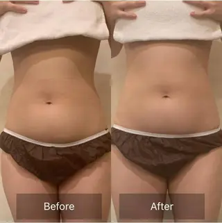 代表 山崎 玲子のエステ・リラクイメージ