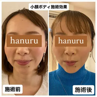 美容整体・小顔矯正 hanuruのエステ・リラクイメージ