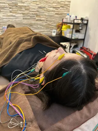 美容鍼灸整体サロンBeauJu所属・小顔矯/美容鍼/鍼灸 BeauJuのその他イメージ