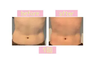 メンズ 癒し腸もみサロン シャユーム　ゆきなのエステ・リラクイメージ