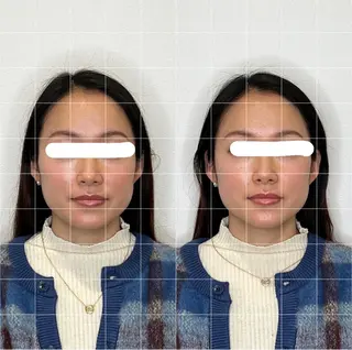 Lenne所属・佐藤 彰太のエステ・リラクイメージ