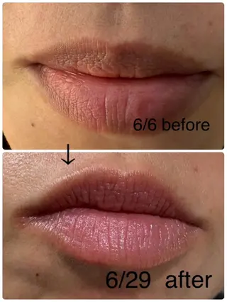 本気で痩せたい方へ 痩身専門サロンのその他イメージ