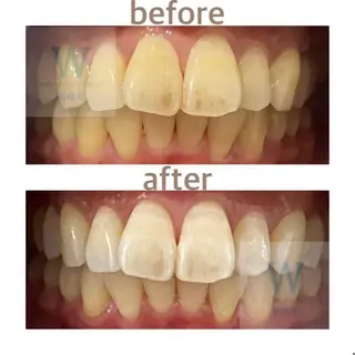 ホワイトニング ショップ船橋店🦷のエステ・リラクイメージ