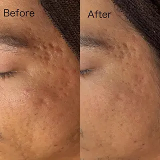 BELLIS HUIT所属・ハーブピーリング那覇 BELLISHUITのエステ・リラクイメージ