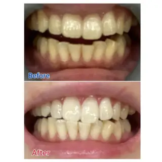 M渋谷店所属・M渋谷 ホワイトニングのその他イメージ