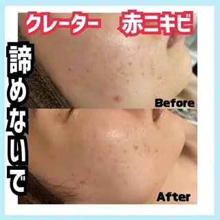 オールハンド専門🤍 kasumiのエステ・リラクイメージ