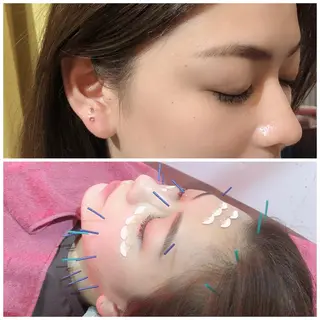 美容鍼灸女性専用 りんご鍼灸治療院のエステ・リラクイメージ