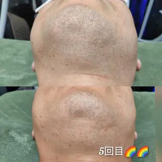 メンズ 武 藤のエステ・リラクイメージ