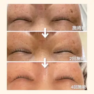 マツエク・マツパ 韓国肌管理 【毛穴専科】のエステ・リラクイメージ