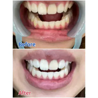 MBEAUTYSALON 千葉店・京成大久保所属・Melty 輝のその他イメージ