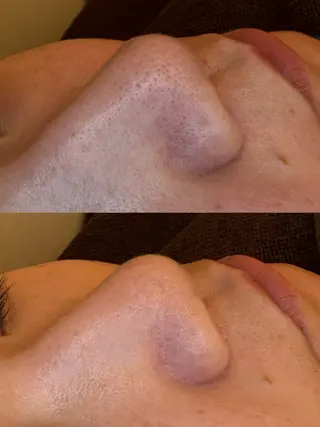 EARTH coiffure beaute 新潟紫竹山店所属・🤍アベシュリ /フェイシャル🤍のエステ・リラクイメージ