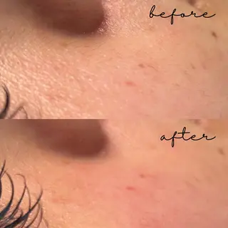 メンズ アイブロウ 眉毛&フェイス WAX専門ハルヒラリの眉毛・アイブロウイメージ