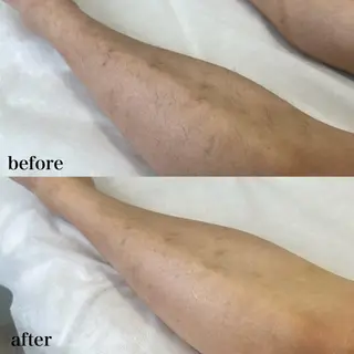 メンズ 瀬戸 梨子のエステ・リラクイメージ