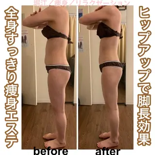 bellissimo 【ベリッシモ】所属・ちひろ　痩身/ハーブ bellissimoのエステ・リラクイメージ