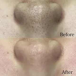 DahliaBeauty ダリアビューティー所属・Dahlia痩身脱毛 フェイシャル 中村のエステ・リラクイメージ