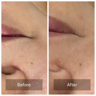 産毛専門店 Bittoのエステ・リラクイメージ