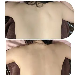 整体エステ　NEW ME所属・深層リンパオイル/小 顔とドライヘッドスパのエステ・リラクイメージ