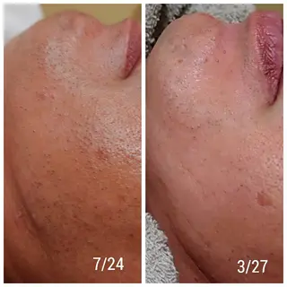 アイブロウ メンズ Beauty Salon Luana所属・Luanaまつパ脱毛 ハーブピーリング眉毛のマツエク・マツパデザイン