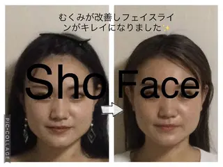 小顔矯正Sho  FaceDesignのエステ・リラクイメージ