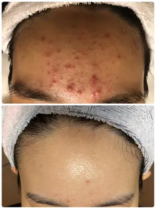 肌育成サロンcoco.A(ココアンジュ)所属・美肌コンサルタント/ 小西晴日のエステ・リラクイメージ