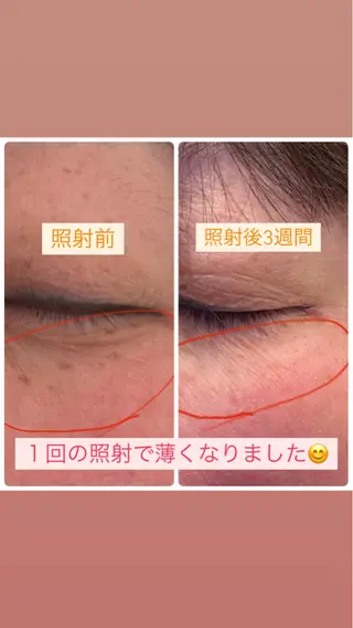 脱毛サロン ねっこぬっこ所属・脱毛サロン ねっこぬっこカネコのエステ・リラクイメージ