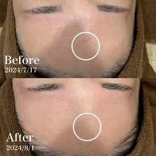 メンズ キッズ Amaryllis 💜河田のエステ・リラクイメージ