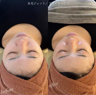 うなじ脱毛/美肌脱毛 LABELのエステ・リラクイメージ