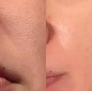 beauty lanaのエステ・リラクイメージ