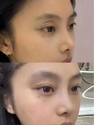 ネイル aliaハイフ&水光ジェットサロン所属・aliaハーブ水光店 エステティシャン募集のエステ・リラクイメージ