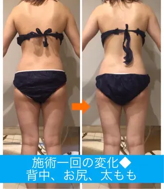 ショート カラー パーマ ヘアアレンジ メンズ キッズ ネイル マツエク・マツパ ‍痩身＆ボディ 結果出し🌟丹野のエステ・リラクイメージ