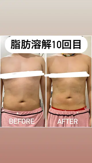 毛穴洗浄・痩身・脱毛 /アルカンジュのエステ・リラクイメージ