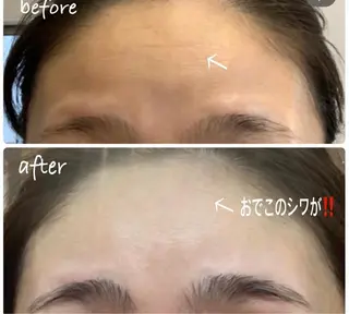 luana beauty所属・kana ハーブピーリング🌿のエステ・リラクイメージ