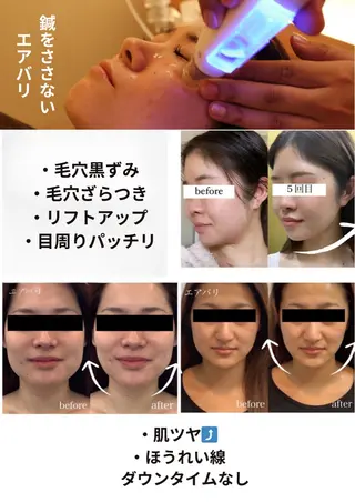 歯のセルフホワイトニング専門店GLOW(グロウ)所属・東区香椎歯のセルフホ ワイトニングGLOWのその他イメージ