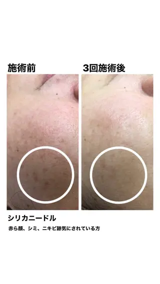 エステティック ロッカのエステ・リラクイメージ