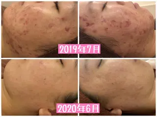 ミディアム カラー パーマ ヘアアレンジ メンズ キッズ ネイル マツエク・マツパ ニキビ・肌質改善専門 ♡人生が変わるサロンのエステ・リラクイメージ