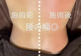 アリュールビューティー所属・エステ/痩身/リラク 🎀KOZUKAのエステ・リラクイメージ