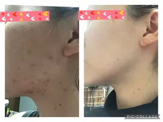 ヨサパーク  ルフ楢原店所属・水素×よもぎ蒸し YOSAPARKルフのエステ・リラクイメージ