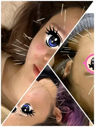 表参道鍼灸院K 美容鍼🔮ララピールのエステ・リラクイメージ