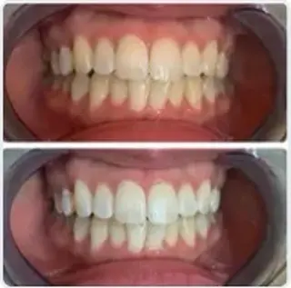 サクッとホワイト所属・セルフホワイトニング サクホワ五反田店のその他イメージ