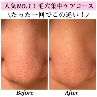 Bellesthe （ベルエステ）のエステ・リラクイメージ